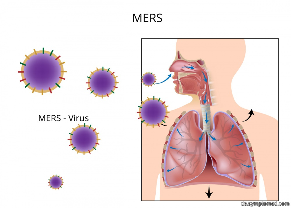 MERS-Virus