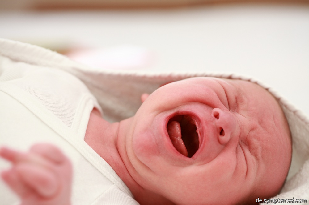 Ein weinendes Baby mit Ringelröteln