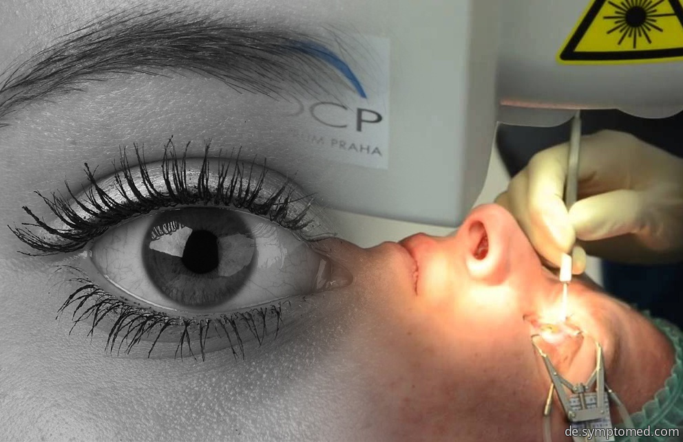 Laseroperation des Auges