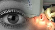 Laseroperationen der Augen