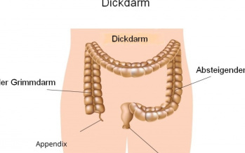 Dickdarm