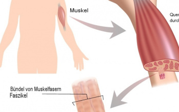Quergestreifte Skelettmuskulatur
