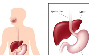 Speiseröhre