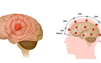 Erste Hilfe bei epileptischem Anfall