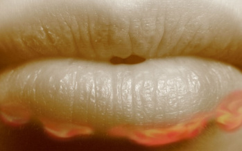 Herpes