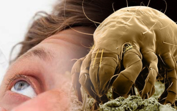 Allergie auf Milben