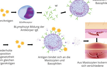 Anaphylaktischer Schock