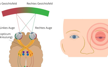Ausfall des Gesichtsfeldes