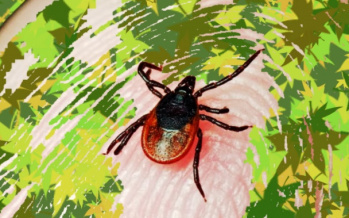Borreliose