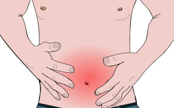 Colitis ulcerosa