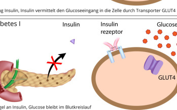 Diabetes