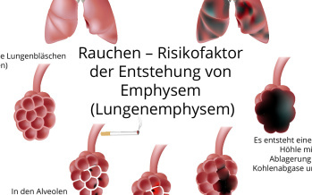 Lungenemphysem