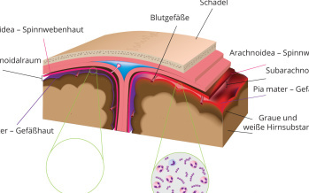 Meningokokkenmeningitis