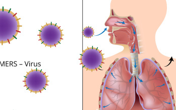 MERS