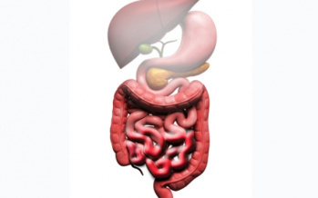 Morbus Crohn