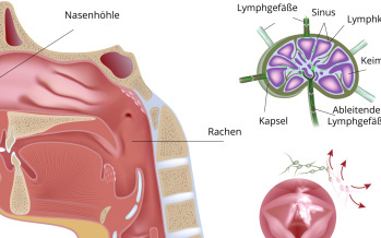 Non-Hodgkin-Lymphom