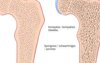 Osteoporose