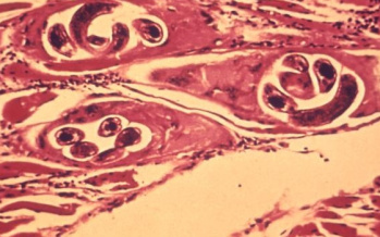 Trichinella spiralis
