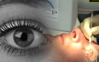 Laseroperationen der Augen
