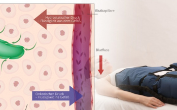 Lymphdrainage, warum ist wichtig sich ihr zu unterziehen