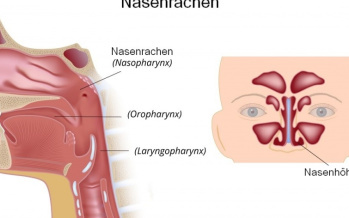 Nasenrachen