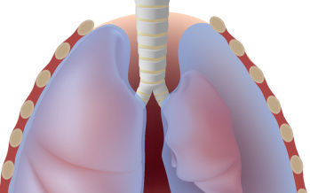 Pneumothorax
