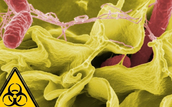 Vergrößerte Lymphknoten