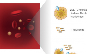 Lipid-Screeningtest