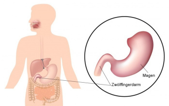 Zwölffingerdarm