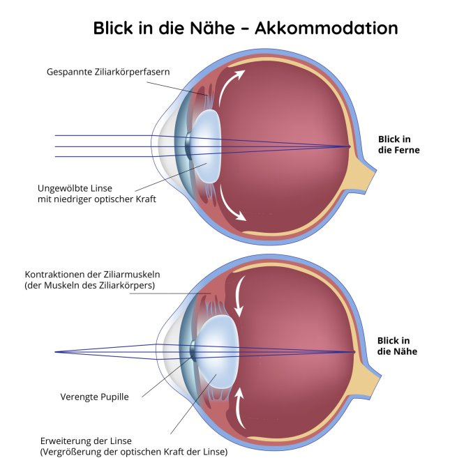 Blick in die Nähe - Akkommodation