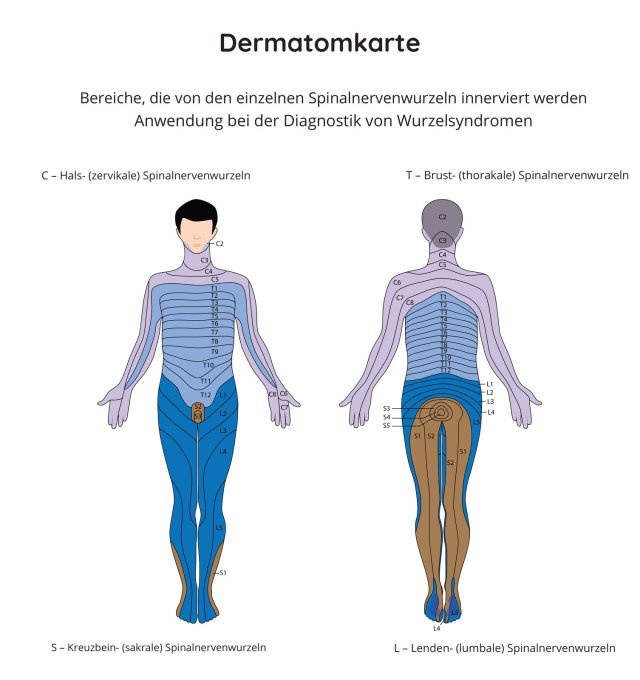 Dermatomkarte