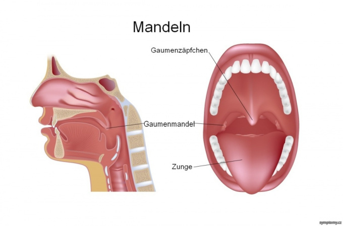 Gaumenmandeln