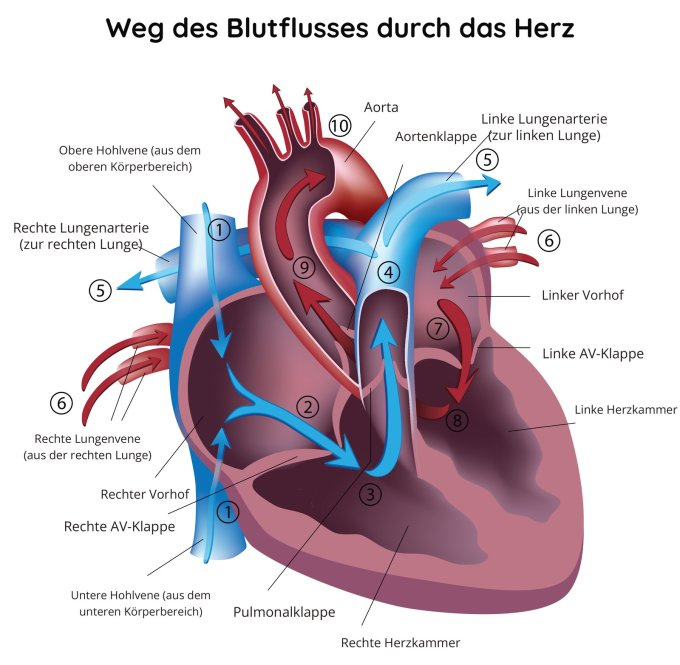 Herzanfall