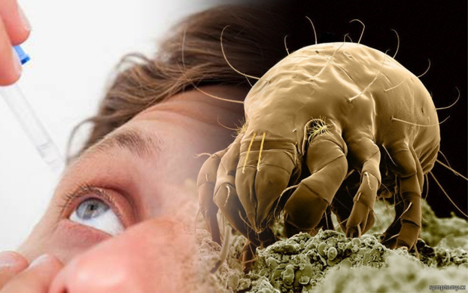 Allergie auf Milben