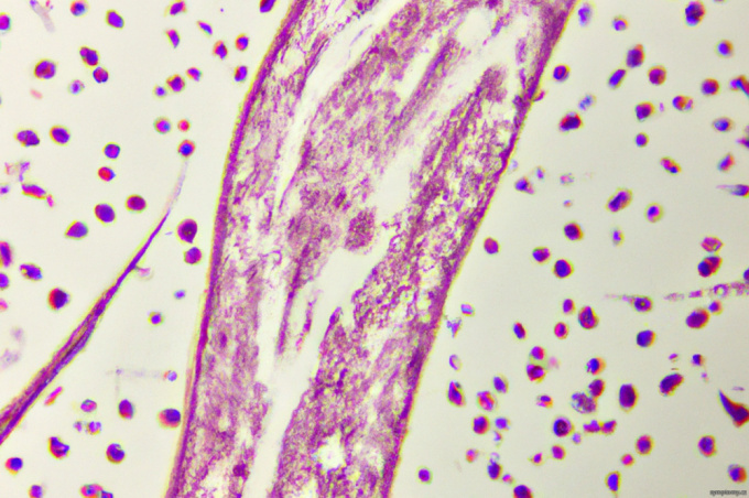 Arteriovenöse Malformation