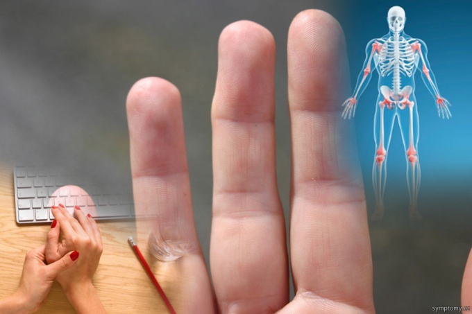 Symptome der Arthropathie