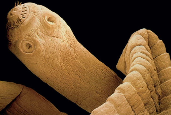 Rinderbandwurm (Taenia saginata)