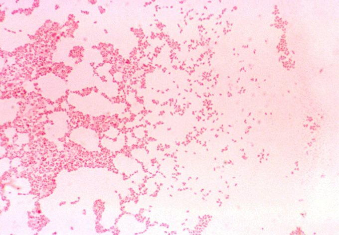 Brucellose