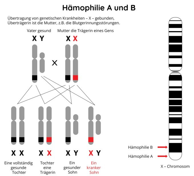 Hämophilie A und B