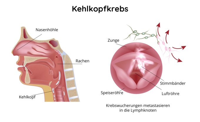 Kehlkopf