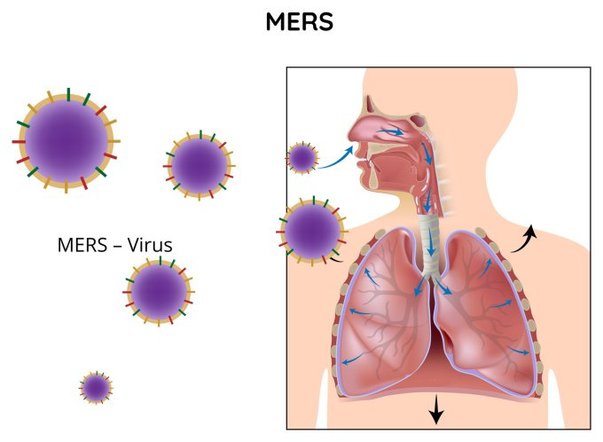 MERS-Virus