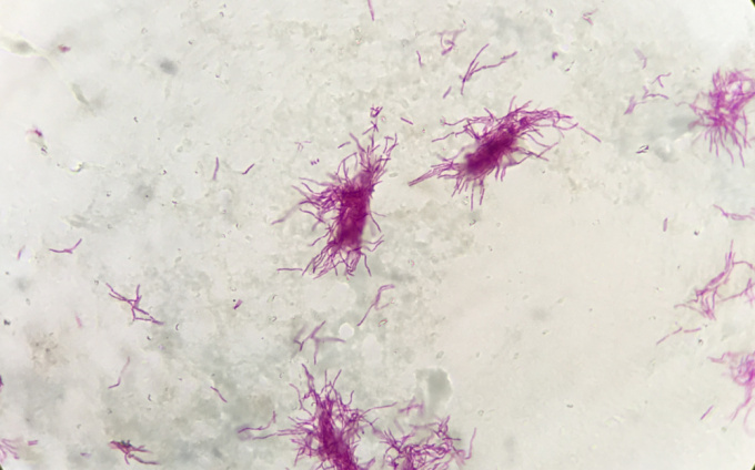 Nocardia