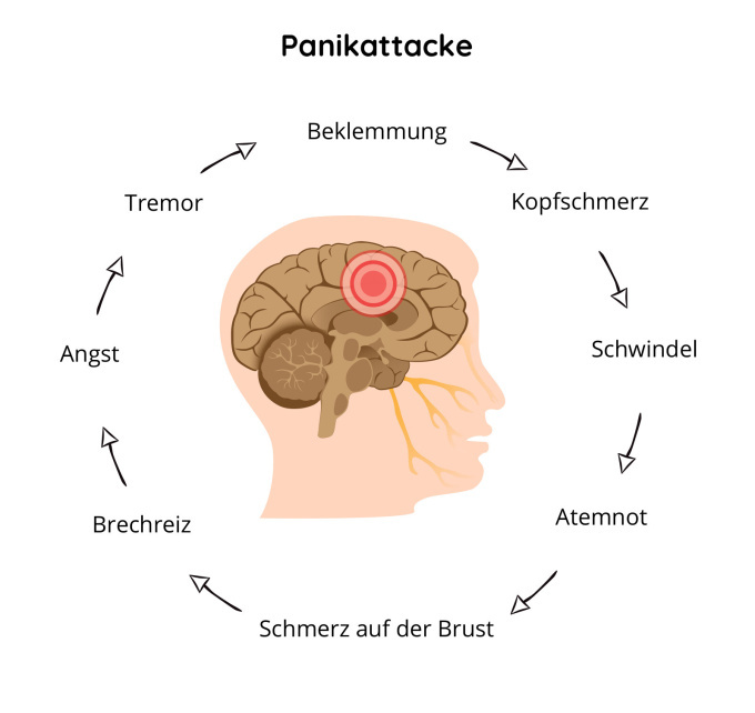 Panikattacke