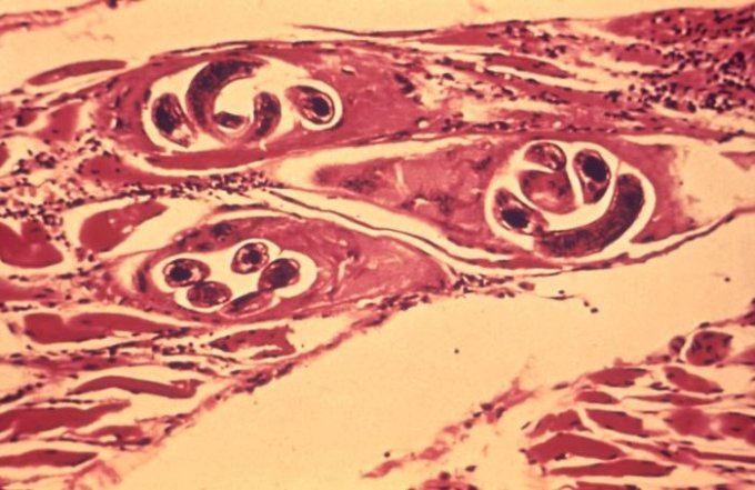 Trichinella spiralis