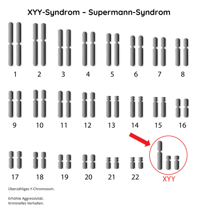 XYY-Syndrom – Supermann-Syndrom