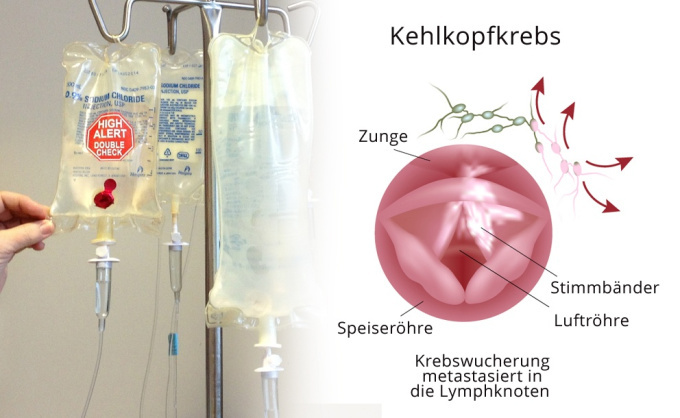 Medikamente gegen Krebs