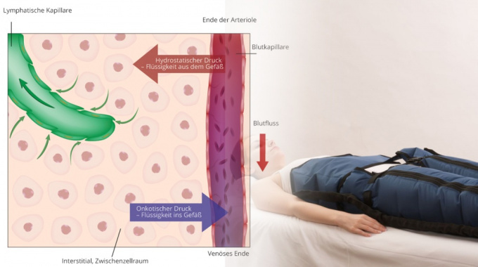 Lymphmassage