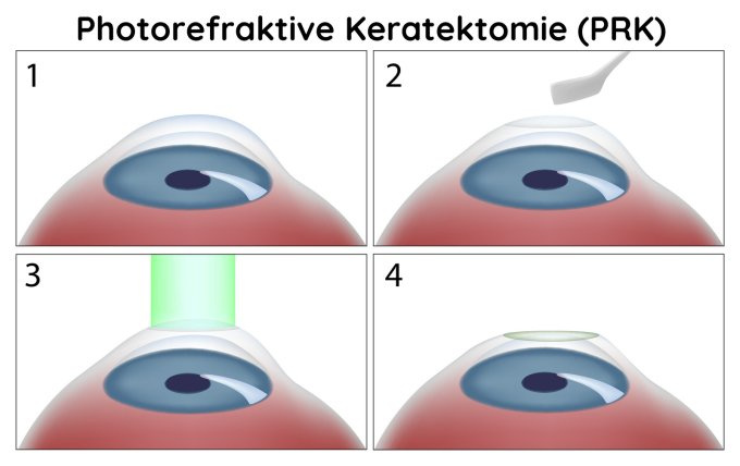 Operation PRK