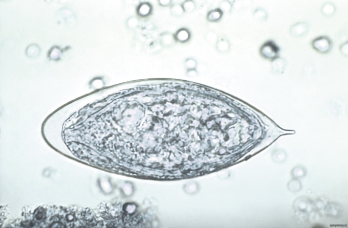Schistosoma haematobium