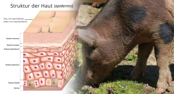 Schweinerotlauf - eine von Schweinefleisch übertragene Erkrankung